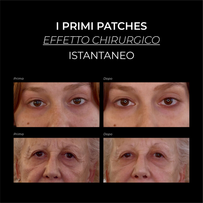 Over Size Eye & Cheek Patches | Trattamento Intensivo Anti-Età