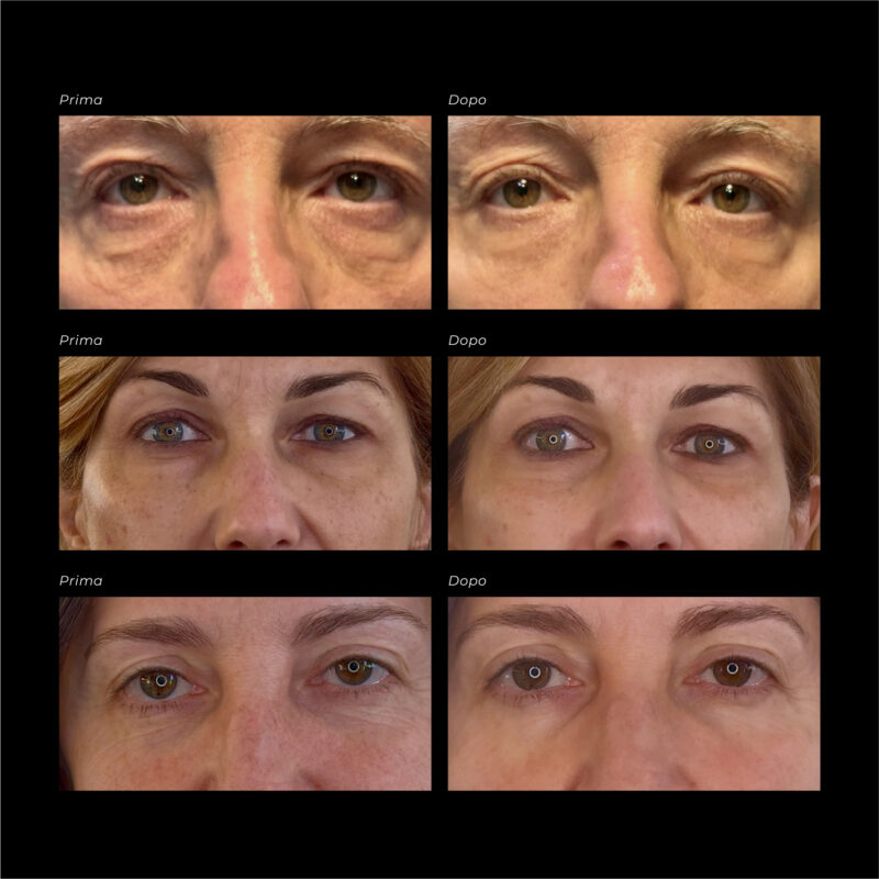 Over Size Eye & Cheek Patches | Trattamento Intensivo Anti-Età